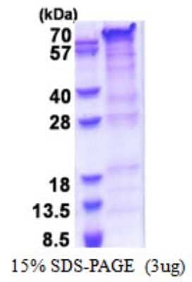 SDS-PAGE: Recombinant Human PRRT2 His Protein [NBP2-51547]