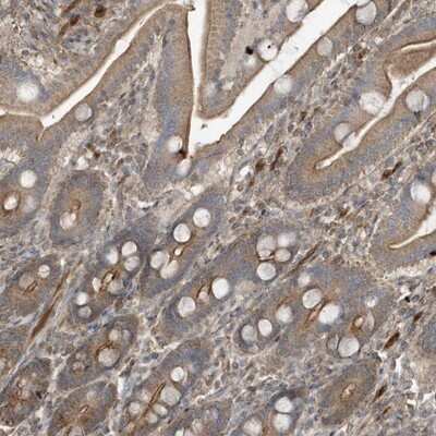 Immunohistochemistry-Paraffin: PRRT3 Antibody [NBP1-93853]