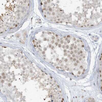 Immunohistochemistry-Paraffin: PRRT3 Antibody [NBP2-33990]