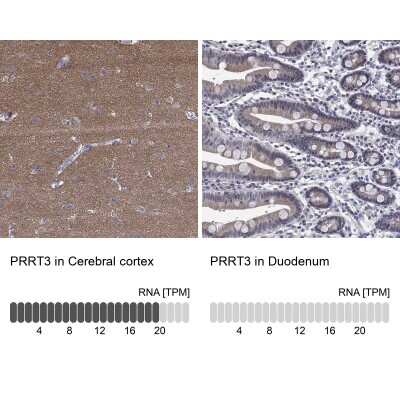 Immunohistochemistry-Paraffin: PRRT3 Antibody [NBP3-17110]