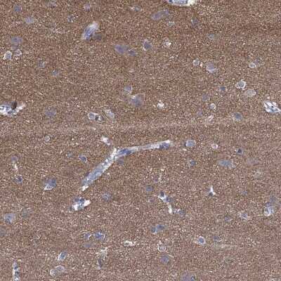 Immunohistochemistry-Paraffin: PRRT3 Antibody [NBP3-17110]