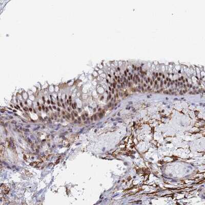 Immunohistochemistry: PRRT4 Antibody [NBP2-37917]