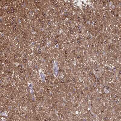 Immunohistochemistry: PRRT4 Antibody [NBP2-37936]