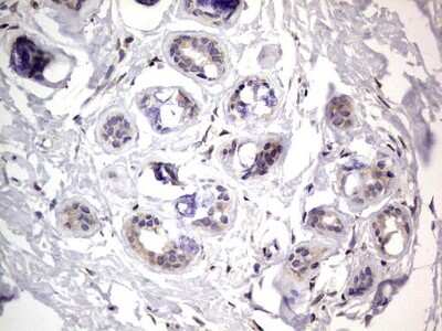 Immunohistochemistry: PRRX1 Antibody (OTI1E10) [NBP2-45407]