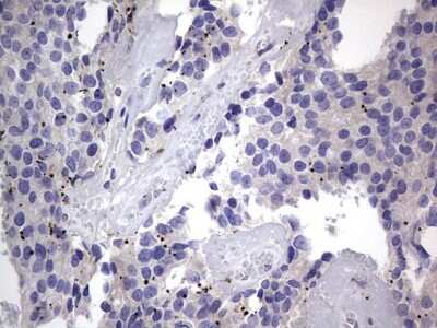 Immunohistochemistry: PRRX1 Antibody (OTI1E10) [NBP2-45407]