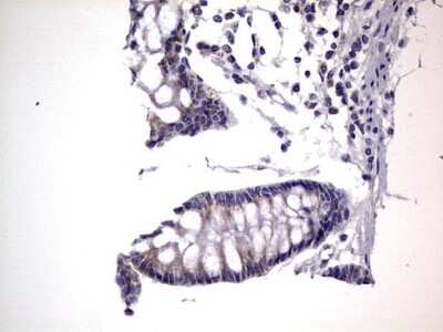 Immunohistochemistry: PRRX1 Antibody (OTI1E10) [NBP2-45407]