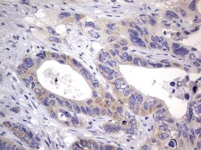 Immunohistochemistry: PRRX1 Antibody (OTI1E10) [NBP2-45407]