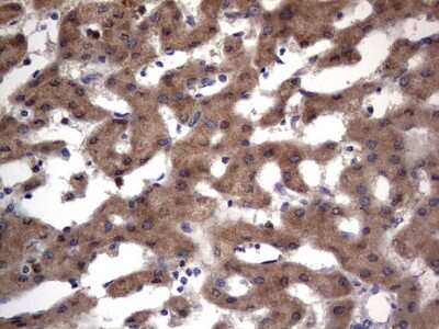 Immunohistochemistry: PRRX1 Antibody (OTI1E10) [NBP2-45407]