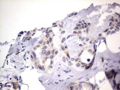Immunohistochemistry: PRRX1 Antibody (OTI1E10) [NBP2-45407]