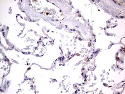 Immunohistochemistry: PRRX1 Antibody (OTI1E10) [NBP2-45407]