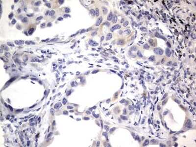 Immunohistochemistry: PRRX1 Antibody (OTI1E10) [NBP2-45407]