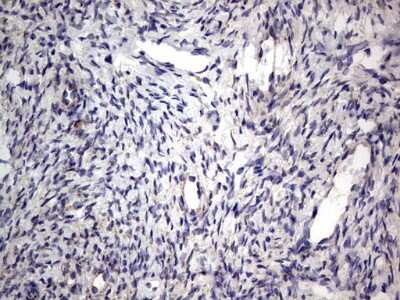 Immunohistochemistry: PRRX1 Antibody (OTI1E10) [NBP2-45407]