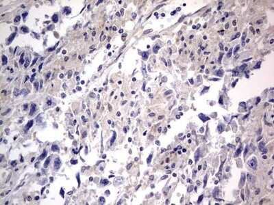Immunohistochemistry: PRRX1 Antibody (OTI1E10) [NBP2-45407]