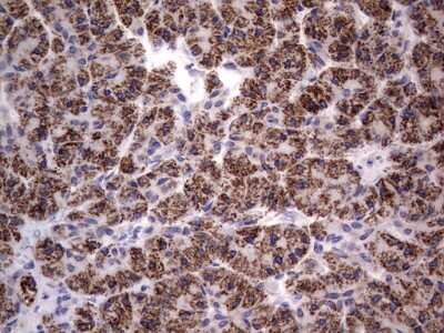 Immunohistochemistry: PRRX1 Antibody (OTI1E10) [NBP2-45407]
