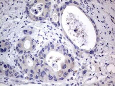 Immunohistochemistry: PRRX1 Antibody (OTI1E10) [NBP2-45407]