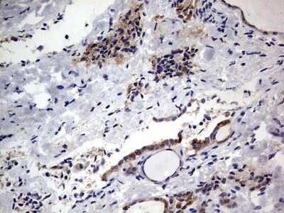 Immunohistochemistry: PRRX1 Antibody (OTI1E10) [NBP2-45407]