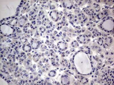 Immunohistochemistry: PRRX1 Antibody (OTI1E10) [NBP2-45407]