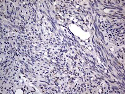 Immunohistochemistry: PRRX1 Antibody (OTI1E10) [NBP2-45407]