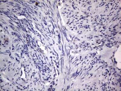 Immunohistochemistry: PRRX1 Antibody (OTI1E10) [NBP2-45407]