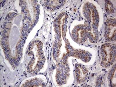 Immunohistochemistry: PRRX1 Antibody (OTI1E10) [NBP2-45407]