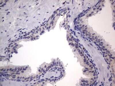 Immunohistochemistry: PRRX1 Antibody (OTI1E10) [NBP2-45407]