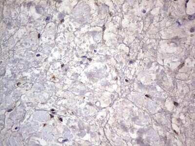 Immunohistochemistry: PRRX1 Antibody (OTI1E10) [NBP2-45407]