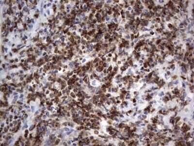 Immunohistochemistry: PRRX1 Antibody (OTI1E10) [NBP2-45407]