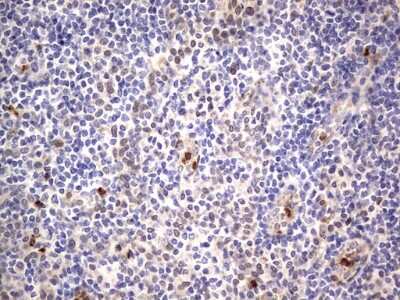 Immunohistochemistry: PRRX1 Antibody (OTI1E10) [NBP2-45407]