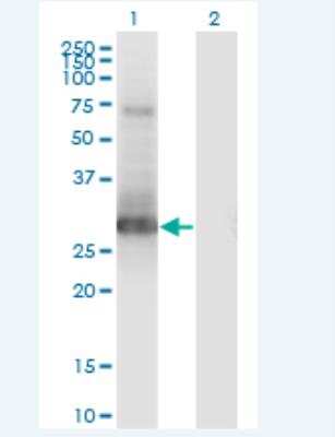 Western Blot: PRRX1 Antibody (1E2) [H00005396-M01-100ug]