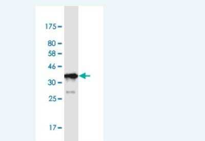 Western Blot: PRRX1 Antibody (1E2) [H00005396-M01-100ug]