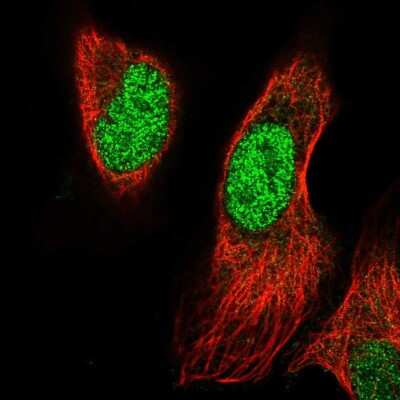 Immunocytochemistry/ Immunofluorescence: PRRX1 Antibody [NBP2-68808]