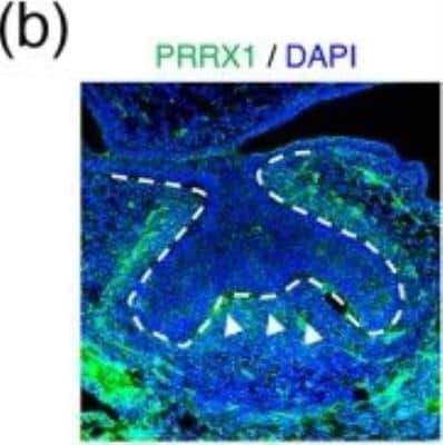 Immunohistochemistry: PRRX1 Antibody [NBP1-06067]