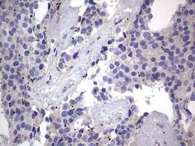 Immunohistochemistry: PRRX1 Antibody (OTI1E10) - Azide and BSA Free [NBP2-73678]