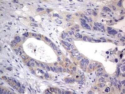 Immunohistochemistry: PRRX1 Antibody (OTI1E10) - Azide and BSA Free [NBP2-73678]