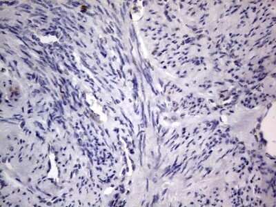 Immunohistochemistry: PRRX1 Antibody (OTI1E10) - Azide and BSA Free [NBP2-73678]