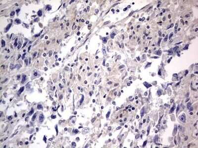 Immunohistochemistry: PRRX1 Antibody (OTI1E10) - Azide and BSA Free [NBP2-73678]