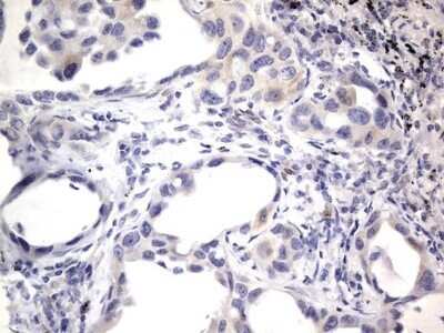 Immunohistochemistry: PRRX1 Antibody (OTI1E10) - Azide and BSA Free [NBP2-73678]