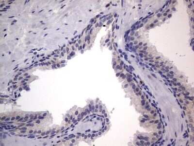 Immunohistochemistry: PRRX1 Antibody (OTI1E10) - Azide and BSA Free [NBP2-73678]