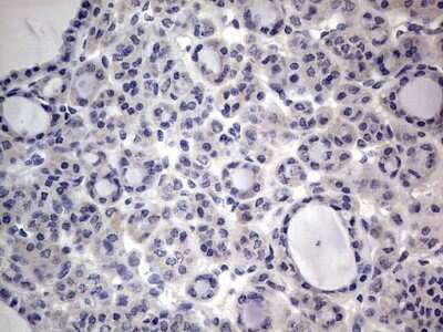 Immunohistochemistry: PRRX1 Antibody (OTI1E10) - Azide and BSA Free [NBP2-73678]