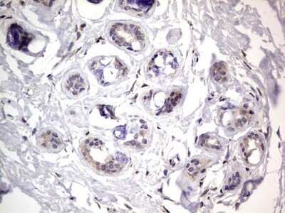 Immunohistochemistry: PRRX1 Antibody (OTI1E10) - Azide and BSA Free [NBP2-73678]
