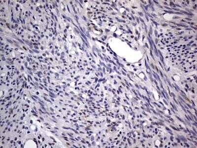 Immunohistochemistry: PRRX1 Antibody (OTI1E10) - Azide and BSA Free [NBP2-73678]