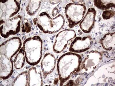 Immunohistochemistry: PRRX1 Antibody (OTI1E10) - Azide and BSA Free [NBP2-73678]