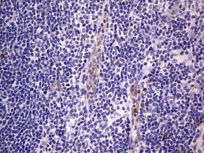 Immunohistochemistry: PRRX1 Antibody (OTI1E10) - Azide and BSA Free [NBP2-73678]