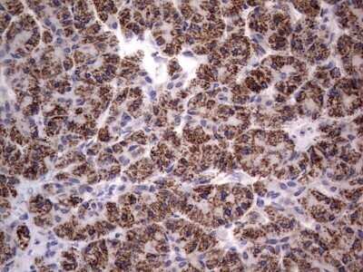 Immunohistochemistry: PRRX1 Antibody (OTI1E10) - Azide and BSA Free [NBP2-73678]