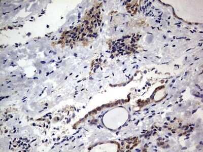 Immunohistochemistry: PRRX1 Antibody (OTI1E10) - Azide and BSA Free [NBP2-73678]