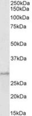 Western Blot: PRRX1 Antibody [NBP1-06067]