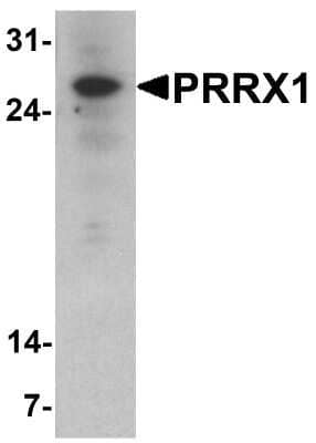 Western Blot: PRRX1 AntibodyBSA Free [NBP2-81848]