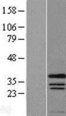 Western Blot: PRRX1 Overexpression Lysate [NBL1-14840]