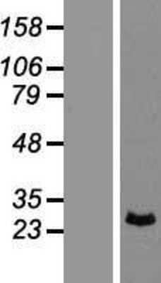 Western Blot: PRRX1 Overexpression Lysate [NBP2-07566]