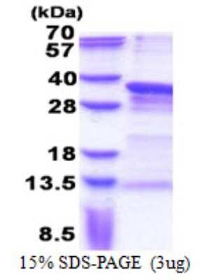 SDS-PAGE: Recombinant Human PRRX1 His Protein [NBP2-23314]